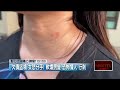 地方治安與詐欺貪瀆案件