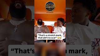 #Rickross #ishowspeed  Bro said you see these scars..😭 #a1hiphop #lol