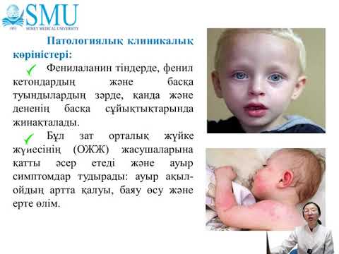 ГЕНДІК МУТАЦИЯЛАР. ГЕНДІК АУРУЛАР. БИОХИМИЯЛЫҚ ӘДІС