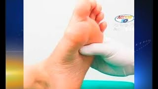 Las causas y síntomas del pie diabético