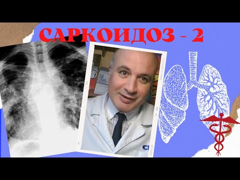 Video: Саркоидоз сизди чарчатабы?