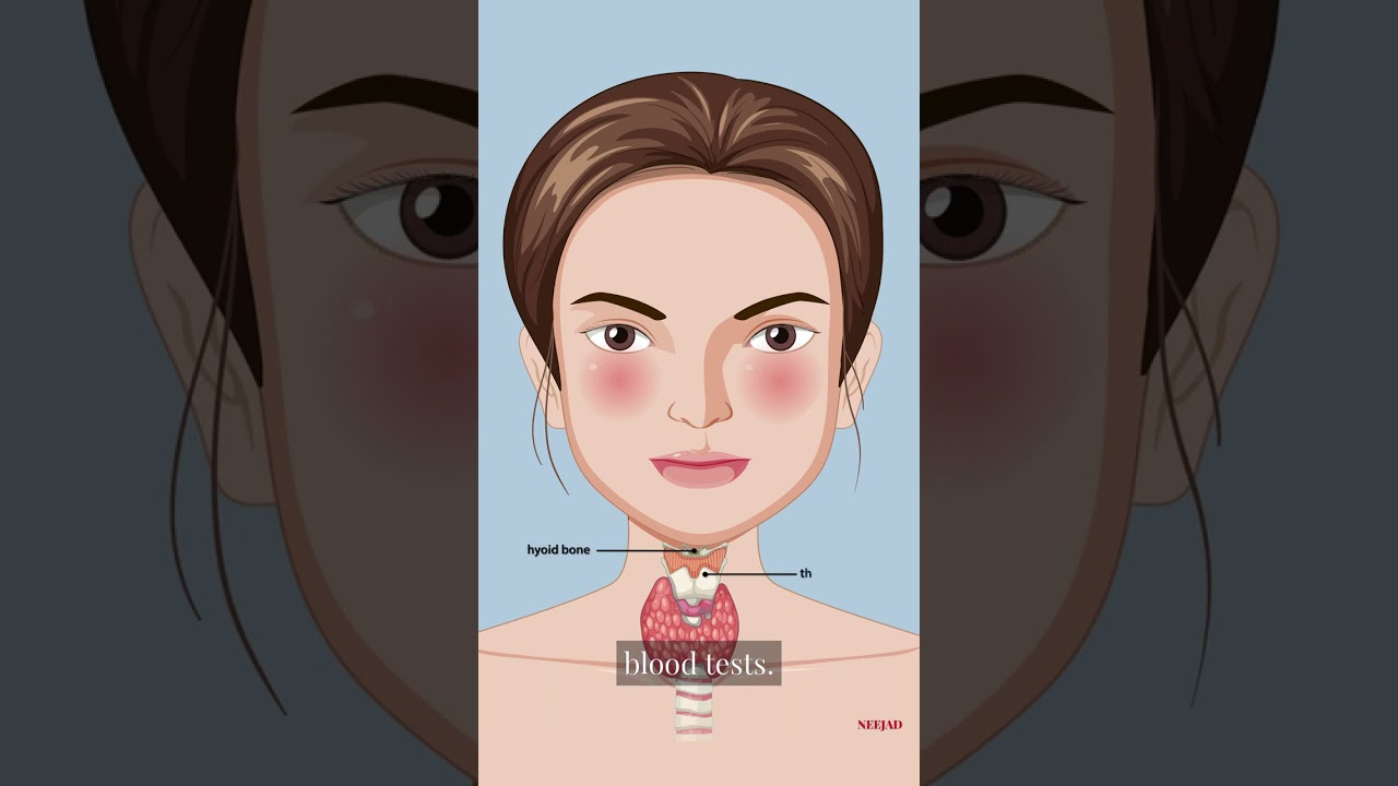What are the symptoms of hyperthyroidism? - Layman Medicine