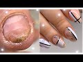 Скоростная техника маникюра😍Секрет тонких линий💅Травмированные ногти💅Nail art