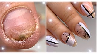 Скоростная техника маникюра😍Секрет тонких линий💅Травмированные ногти💅Nail art