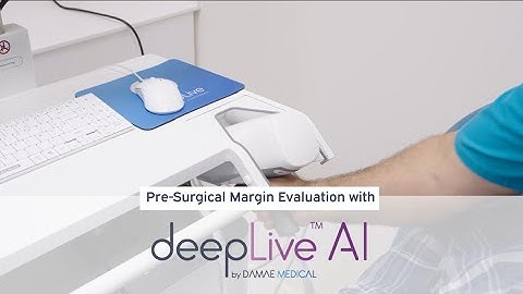 Pre-Surgical Margins Evaluation with deepLive™ AI