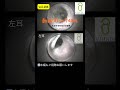 耳掃除 vol.186 #shorts #耳掃除#イヤーエステサロンVillalo