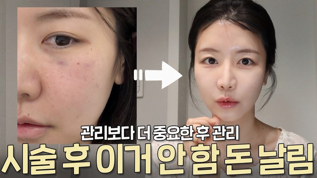 시술 후 관리 제대로 안 하면 효과 ZERO! 실제로 상처 지대로 난 피부 복구 과정 공유합니다📝 (리쥬란힐러 효과 후기, 레이저 후 재생크림 추천, 붓기 붉은기 케어)