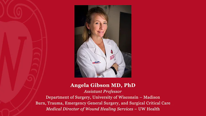 Dr. Angela Gibson's burn research