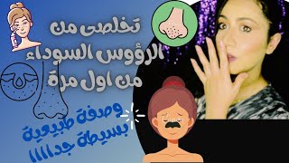 تخلصى من #الرؤوس #السوداء من اول مرة خلطة بسيطة جدااا و فعاللة العناية بالبشرة فى رمضان