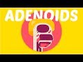 What are Adenoids?