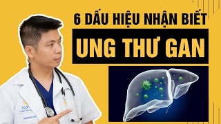 6 Silent Warning Signs of Liver Cancer That Everyone Needs to Recognize Immediately | Dr. Ngoc
