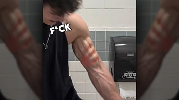 Worst Side Effect of Steroids.. 💀💀💀