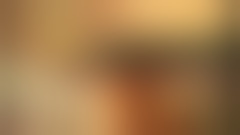 Laparoscopic Component Separation