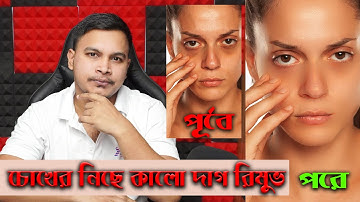 How to remove Under eye Dark Circles in Photoshop in Bangla by Safi Ahmed #safi360