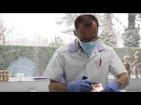 Video: Installatie Van Mondbeschermers In De Tandheelkunde PROPRICUS