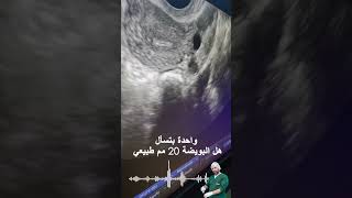 واحدة بتسأل هل البويضة 20 مم طبيعي  shorts#