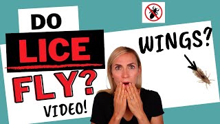 Do Lice Fly? Do Lice Have Wings? Video Tutorial