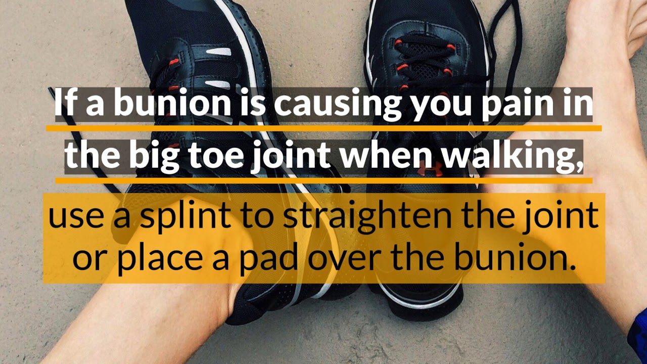 Exercises for Bunions, Hammertoes, Flat feet Seattle Foot Doctor Near