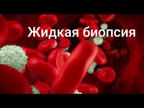 ЖИДКАЯ БИОПСИЯ (ДИАГНОСТИКА ОНКОЛОГИИ)