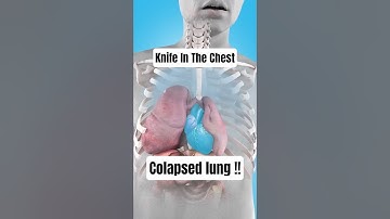 What to do if you puncture a lung