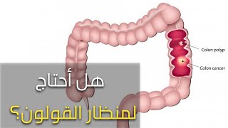 كيف نتجنب سرطان القولون؟