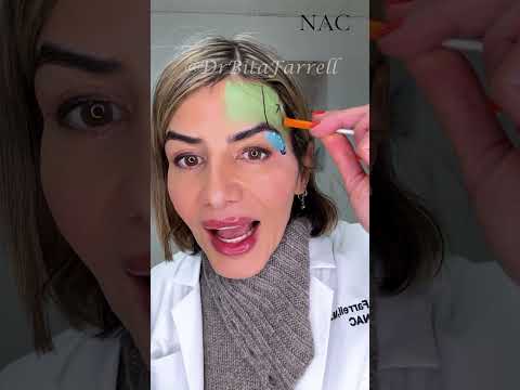 Botoxbrowlift Browlift Botoxtraining Drbitafarrell