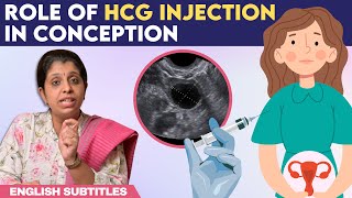 Role Of hCG Injection In Conception | hCG ஊசி செலுத்திய பிறகு கரு முட்டை எப்போது வெளிவரும்? screenshot 5