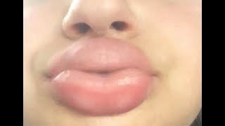 ★Болезненное увеличение губ. Новое веяние моды или глупость по молодости? ★Болезненное увеличение губ. Новое веяние моды или глупость по молодости?