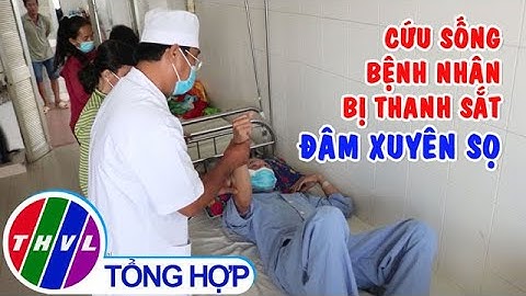 Cứu sống bệnh nhân bị thanh sắt đâm xuyên sọ
