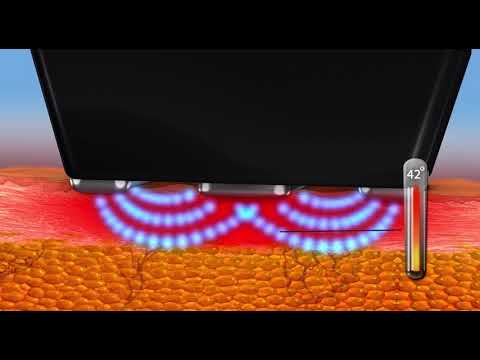 youtube-video-thumbnail