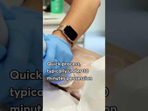 From Lumpy to Smooth: Emtone Treatment for Silky Skin