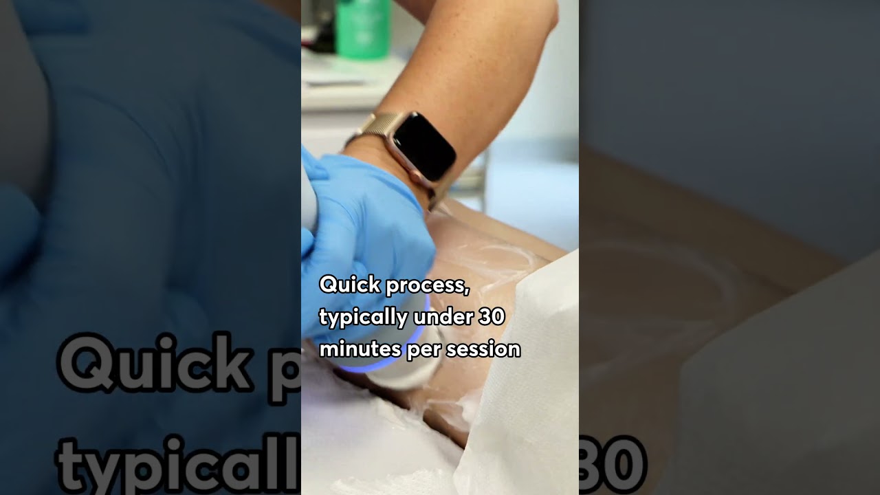 From Lumpy to Smooth: Emtone Treatment for Silky Skin