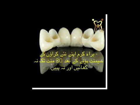 ڈینٹل  كراوون  اور  برج  لگانے کے  بعد  کی  ہدایت instructions after dental crown