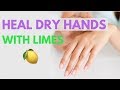 REALLY DRY HANDS Treatment | Hand Scrub