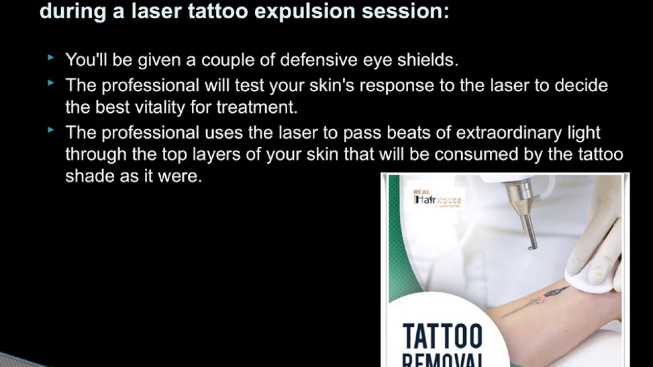 Tattoo removal- Realhairhouse | Tattoo Removal in Delhi - YouTube