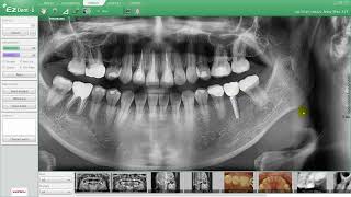 Vatech EzDent i  TUTORIEL - VISIONNEUSE Onglet 02   Simulation - SYNERGY DENTAL
