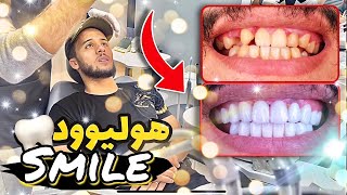 هوليوود سمايل - الحلم تحقق❤️السلبيات و الإيجابيات 🔥