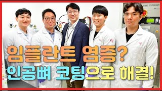 [연구자 TALK] 임플란트 염증? 인공뼈 코팅으로 해결한다!