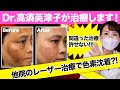 【シミ治療】他院で5年間レーザー治療…より酷くなってしまった顔のシミを治します！【炎症後色素沈着】