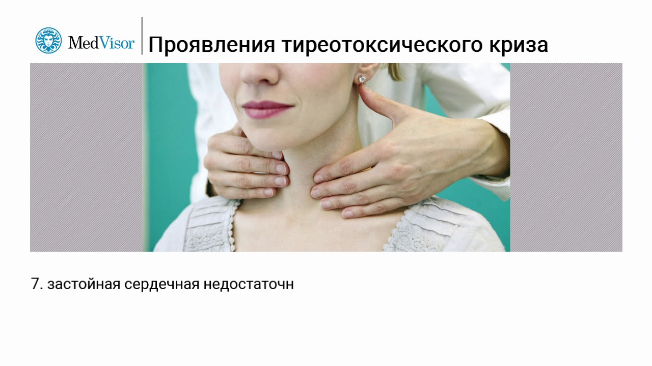 Проявления тиреотоксического криза