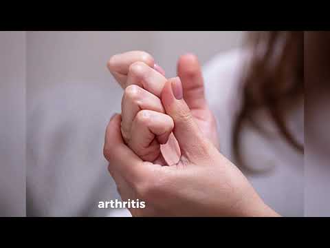 Does Cracking Your Knuckles Cause Arthritis? | Doctor Explains