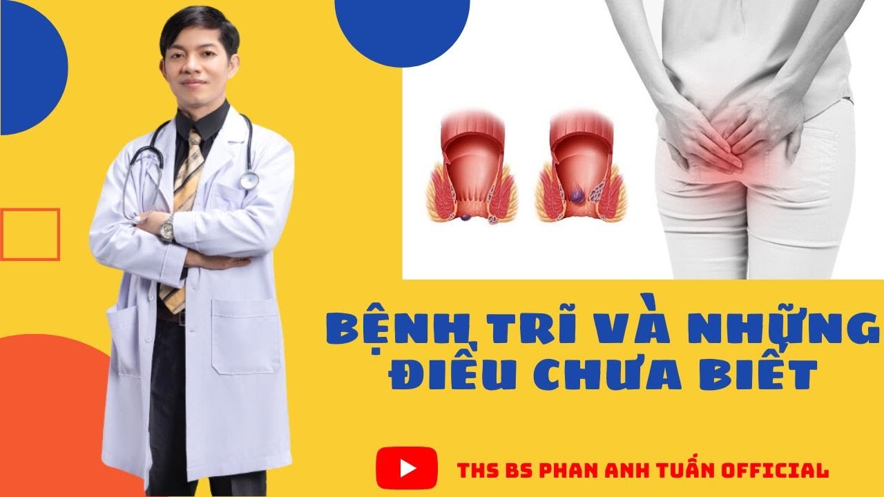 BỆNH TRĨ VÀ NHỮNG ĐIỀU CÓ THỂ BẠN CHƯA BIẾT | MẮC BỆNH TRĨ CẦN XEM NGAY