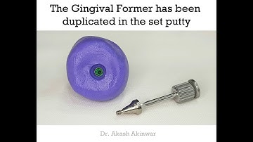 How to Customized Impression Coping -Case By Dr.  Akash Akinwar