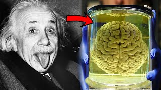 जानिए Albert Einstein का दिमाग क्यों था खास  Einstein Brain In Hindi  Albert Einstein Facts