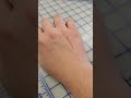 Sewing Pin Bite!!! Gotta love when you don't feel them happen!
