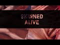 Skinned alive what is it like to be skinned alive