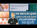 Dermiford के लाभ और उपयोग करने का तरीका - Dermiford Cream Benefits &amp; Uses in Hindi.