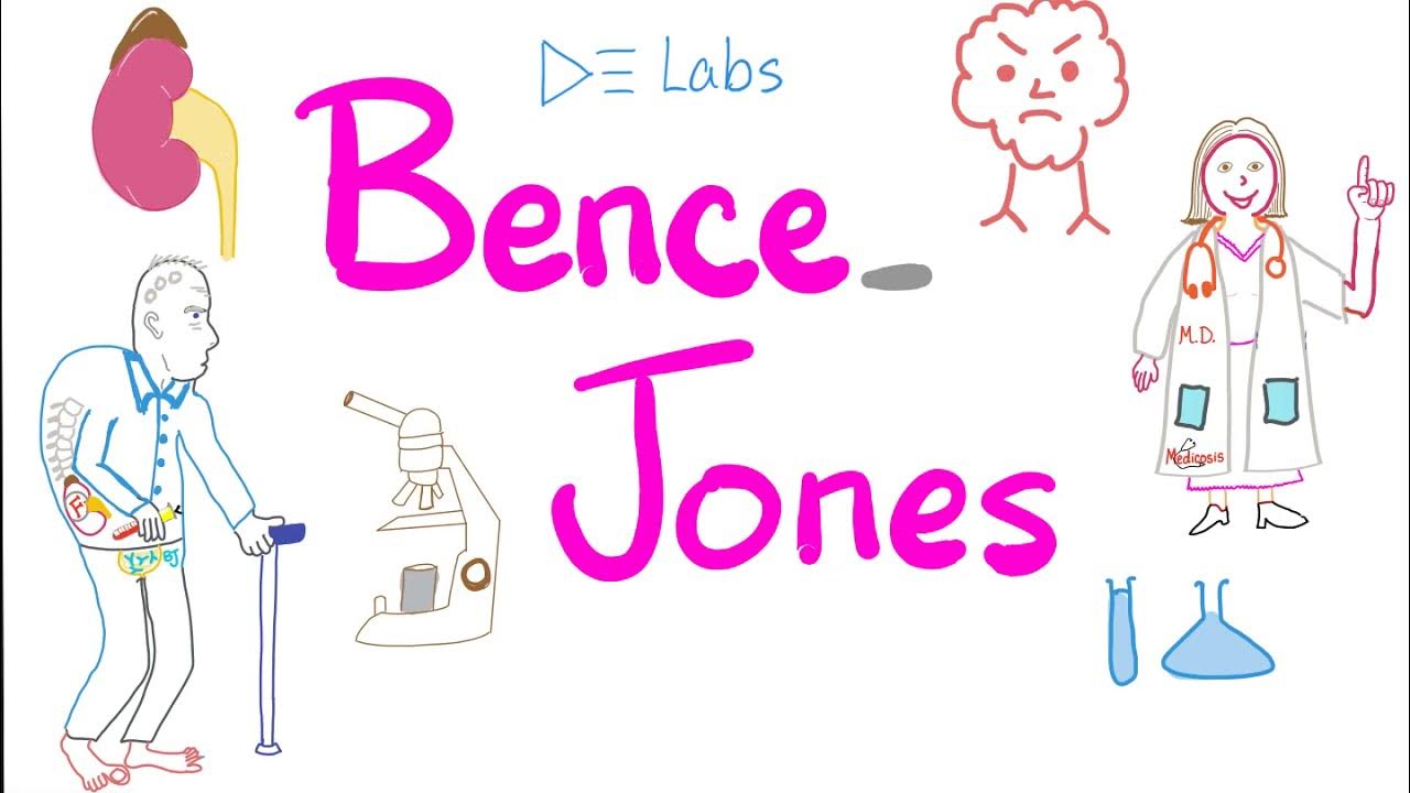 Bence Jones Proteins Multiple Myeloma Urine Test YouTube
