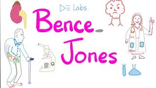 Bence Jones Proteins - Multiple Myeloma - Urine Test