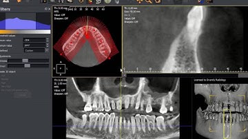 QuickVision 3D - How to draw panoramic curve - OWANDY RADIOLOGY